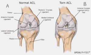 a trusted center providing specialized care, surgical treatments, and rehabilitation for musculoskeletal conditions in Atlanta_Medicobridge.