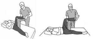 a technique for reducing hip dislocations by using the physician’s knee as a fulcrum to apply controlled force and reposition the femoral head into the acetabulum_Medicobridge.