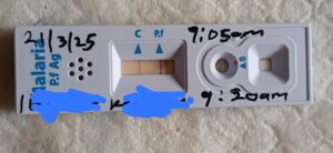 A malaria rapid test cassette showing a positive result for Plasmodium falciparum, with handwritten annotations including a date, times, and redacted text.