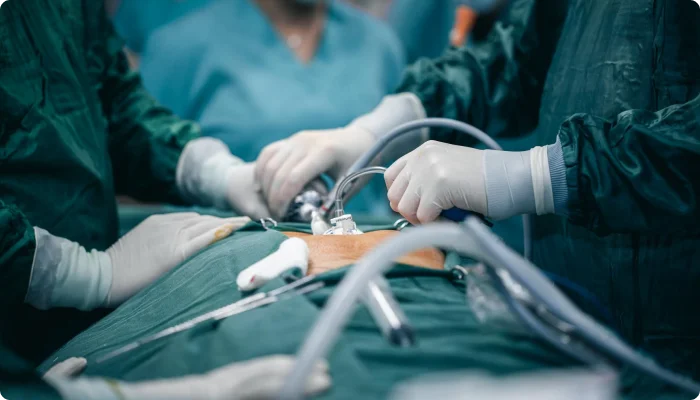 Rules of thumb in Surgery